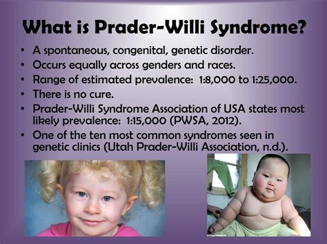 prada willi toddler|prader willi syndrome inherited.